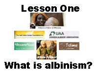 albinism lesson one