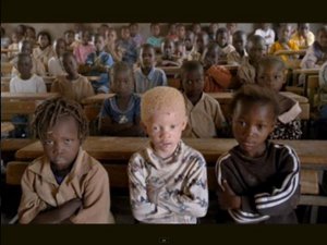 In un'aula, un bambino africano albino, seduto accanto a bambini africani neri