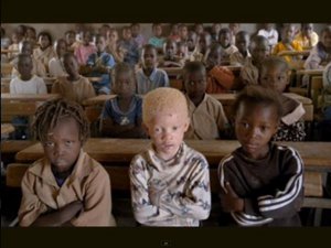 aula scolastica: un bimbo africano albino