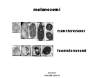 Albinismo: melanosomi