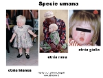 Albinismo immagini: albinismo nell'uomo