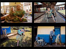 Albinismo Africa (Tanzania): 4 foto che raccontano la storia di Bibiana