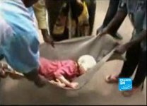 foto di bimbo albino ferito a morte