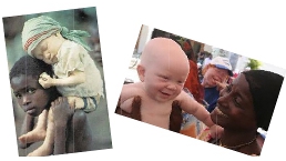 Albinismo in Africa: un dramma sociale e culturale