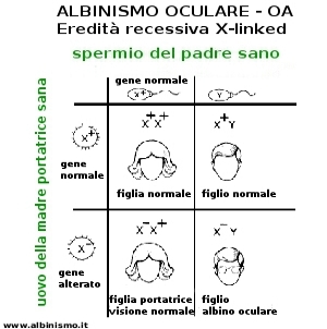 schema: eredità albinismo oculare