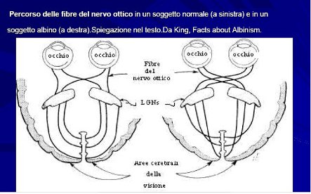 testo scientifico sull'albinismo copiato dalla rete