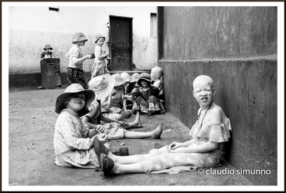 i bambini albini di Buanghija